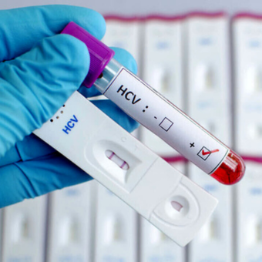 Progetto test salivari per screening HCV